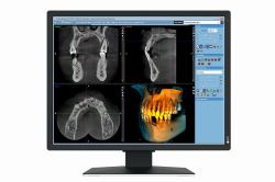 EIZO RadiForce MX217-SB pantalla para PC 53,3 cm [21"] 1200 x 1600 Pixeles UXGA LCD Negro 